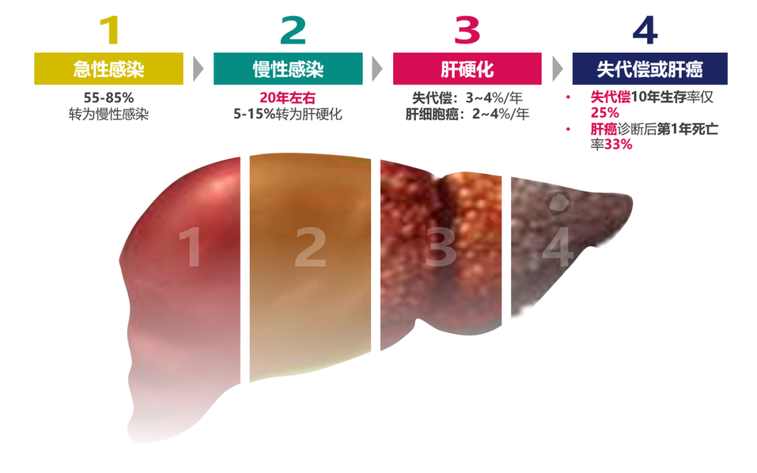 悄悄变成肝硬化、肝癌，很多人感染了却不知道